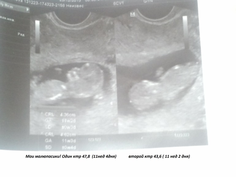 Принимайте новичка))).