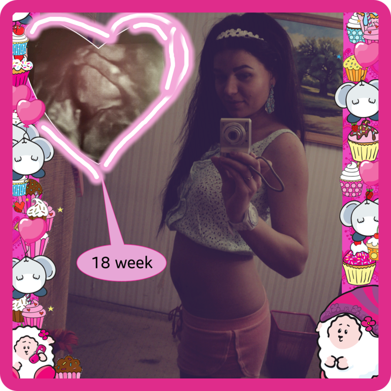 Наши 18 неделек)))