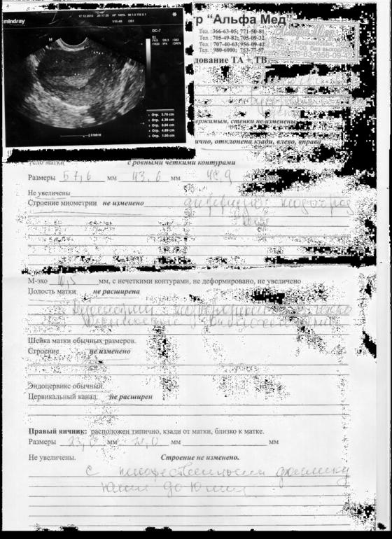 Дечоночки, разве может быть такая киста на яичнике? Гляньте пожалуйста на рисунок