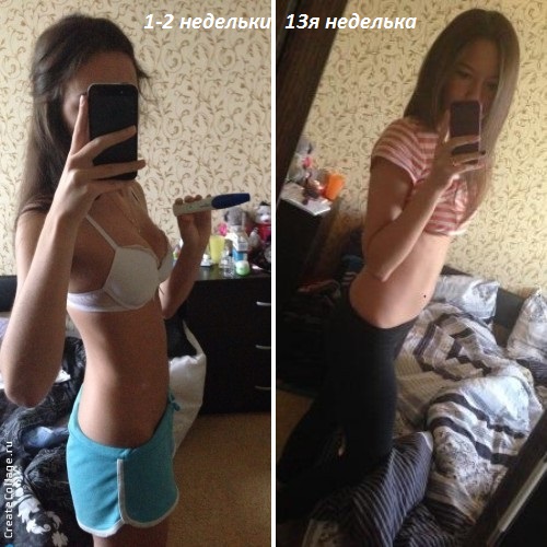 1ый скрининг)