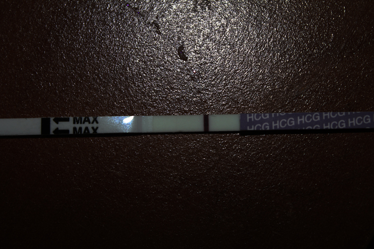 у меня галлюцинации?