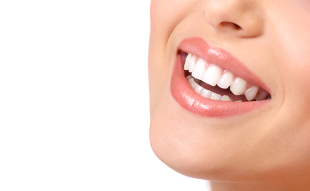 Брекеты Дамон клеа