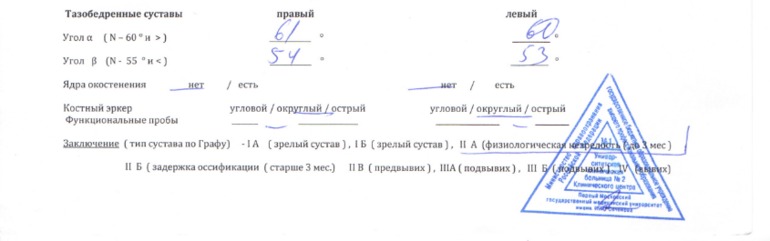 Подозрение на дисплазию