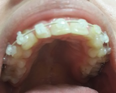 9 месяцев спустя