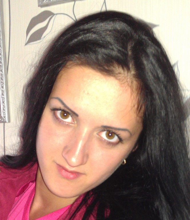 Стоит ли увеличивать губы?