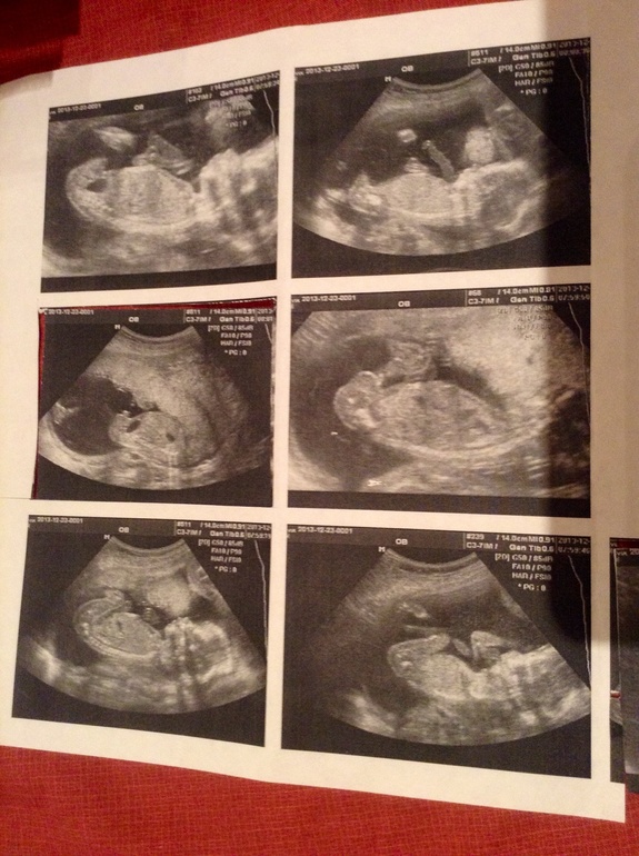 Точно мальчик?:)