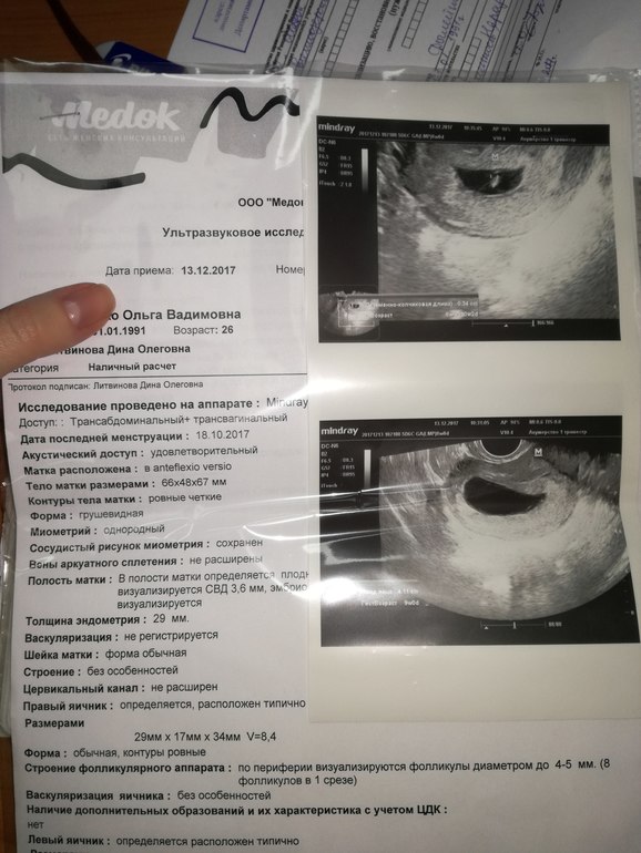 Вязание пинеток карамелек спицами Вязание пинеток карамелек спицами