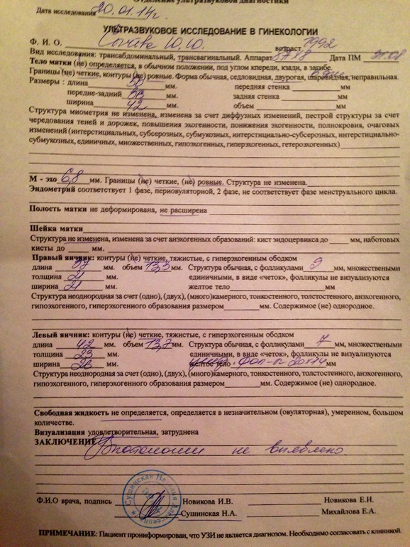 Это овуля?)))