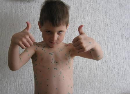 Леопёрдик
