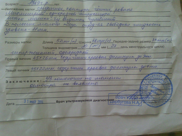УЗи