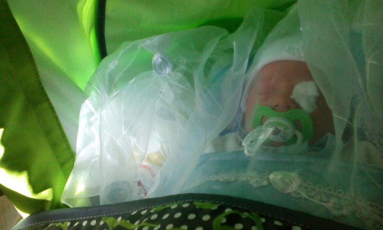 непроходимость слезного канала(((