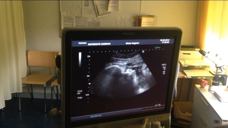 наши портретные Узи в конце 38-ой недели