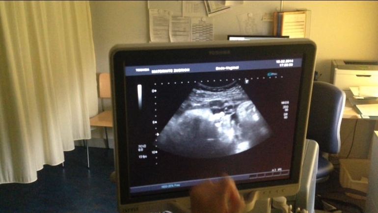 наши портретные Узи в конце 38-ой недели