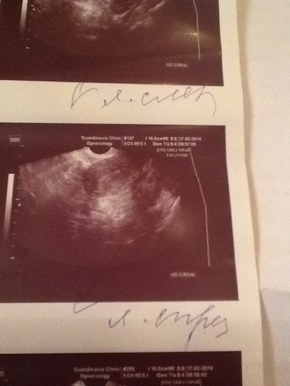 Слово гинеколога не обсуждается??или??