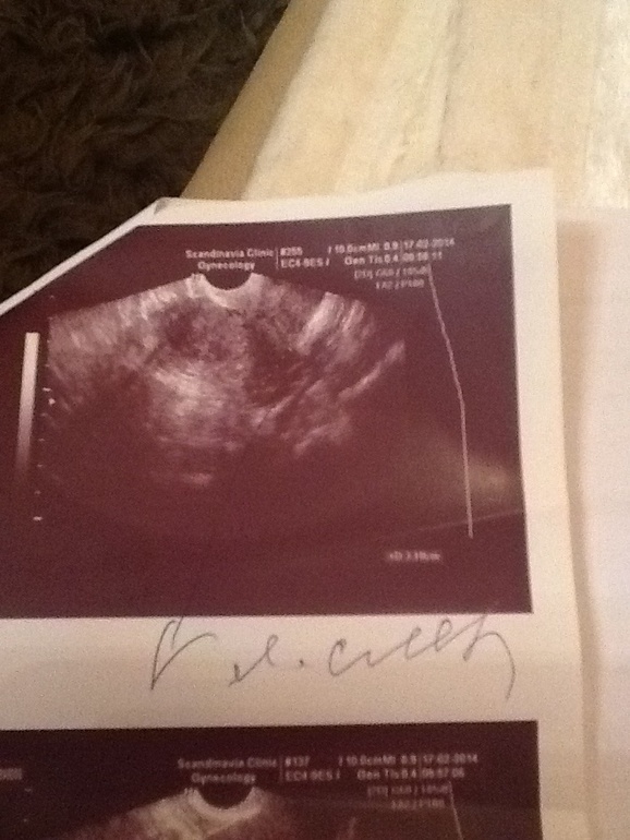 Слово гинеколога не обсуждается??или??