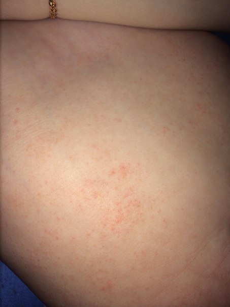 Девочки помогите...сил нет