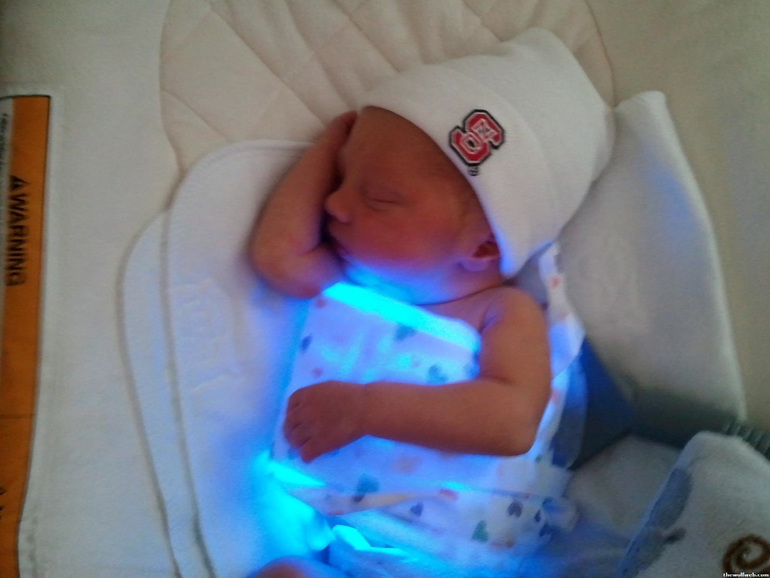 Плановое кесарево сечение, стерилизация,Новая жизнь!!