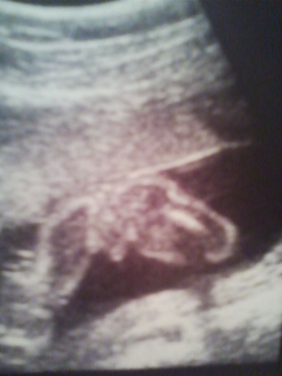 Наше второе узи)))