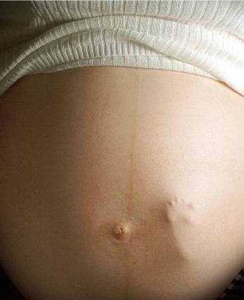 Шевеления плода при беременности: что важно знать на разных сроках