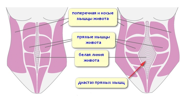 Как сделать линии на животе Как сделать линии на животе