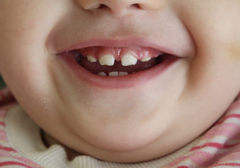 Что это у нас? И что нам делать?