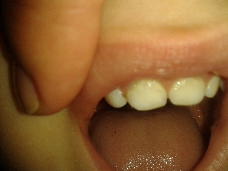 что делать??!!??