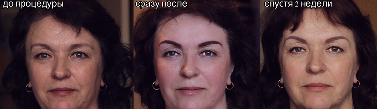 Перманент (до/сразу после/спустя 2 недели)