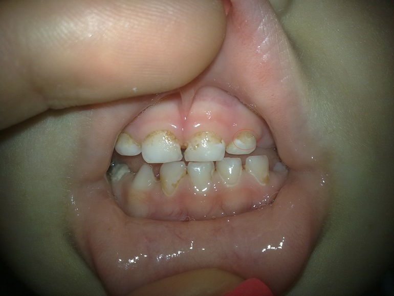 Как лечить?