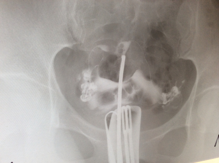 Результаты ГСГ