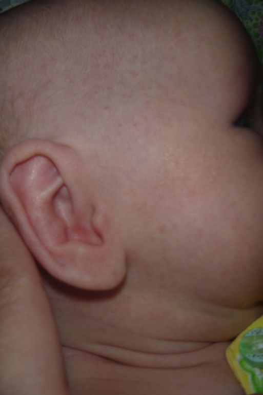 подскажите что это аллергия или что другое????