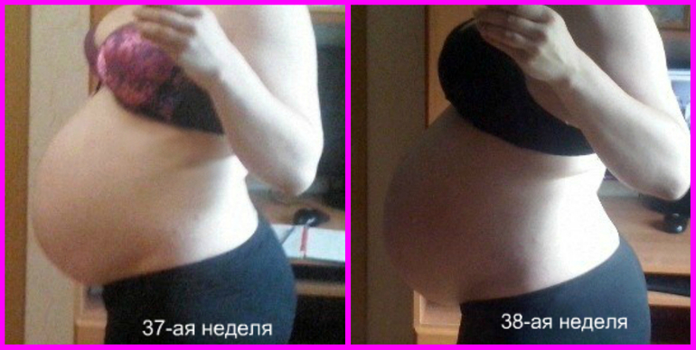 Схватывает поясницу на 39 неделе беременности Схватывает поясницу на 39 неделе беременности