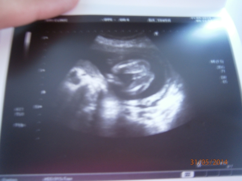 Наше долгожданное УЗИ и пол!!!!!