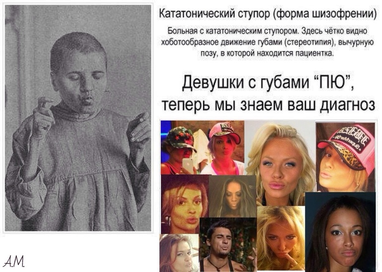 Шиза...