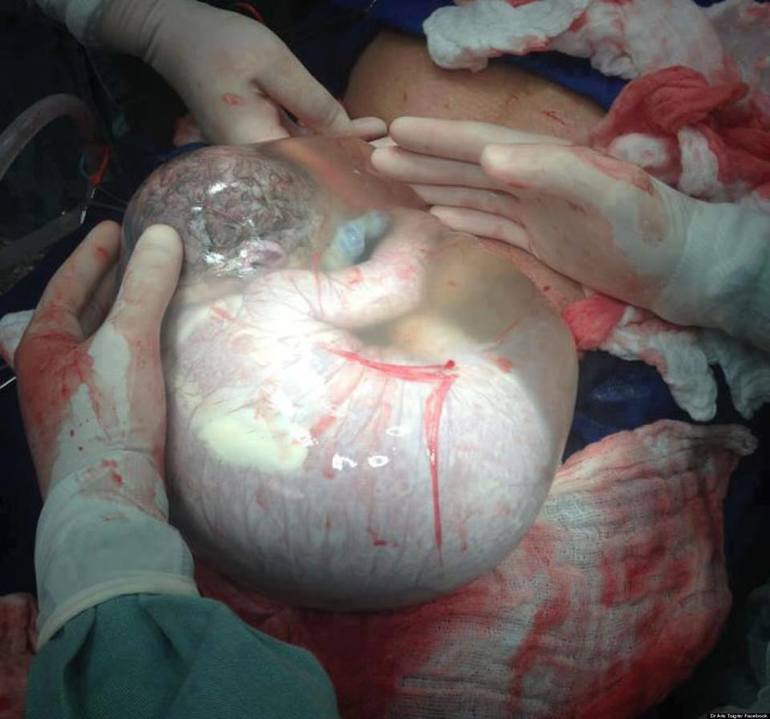 Чудо рождение.