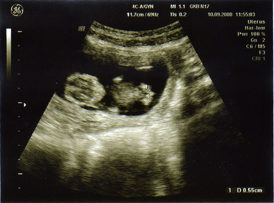 Что я нашла!!!! Рассказ про первые роды!!!