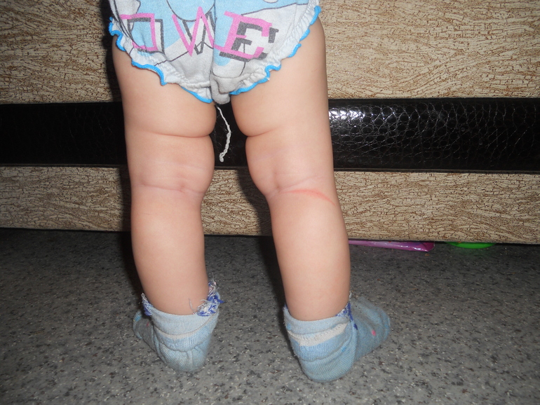 Ножки малышки