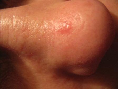 что с моим носом??