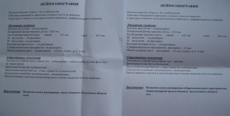 прокомментируйте, если в курсе
