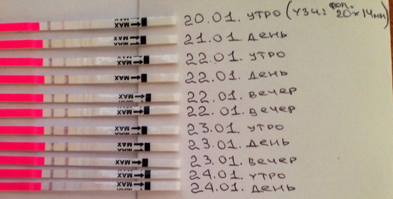 Когда была овуляция? Начинать колоть прогестерон?