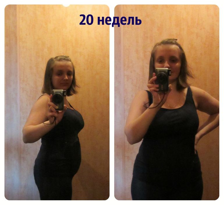 наши 20 нед. и девочка!!!