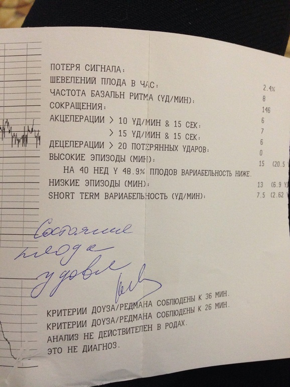 Кто понимает в ктг ?