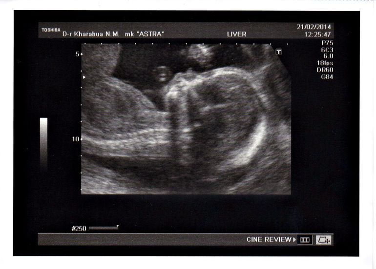 2е плановое узи))