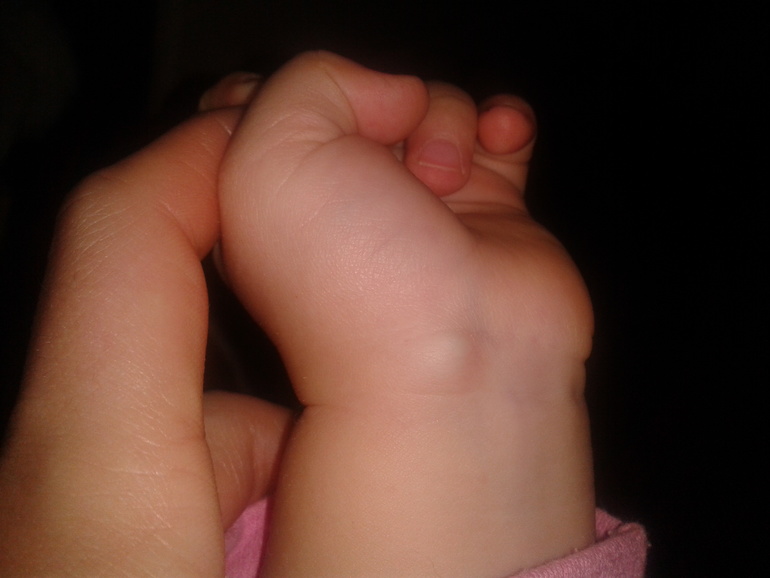 Помогите советом!!! Шишечка((((((((