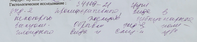 Гистероскопия и гистологическое исследование