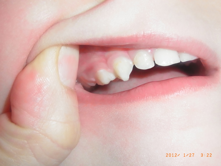 Что делать?