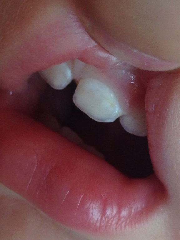 Айкон ребенку 1,5 года