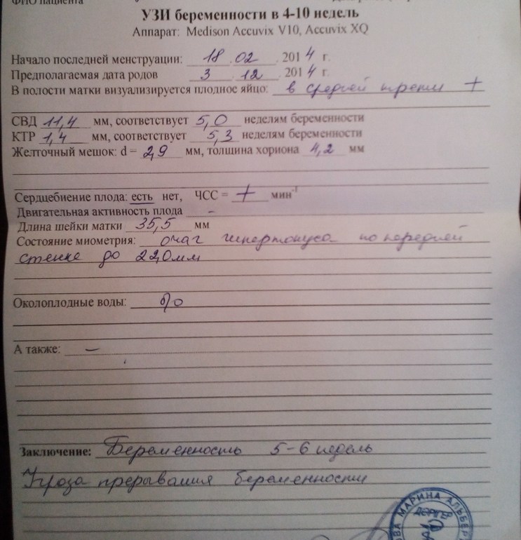 Маленький, но есть....!!!!!!!!