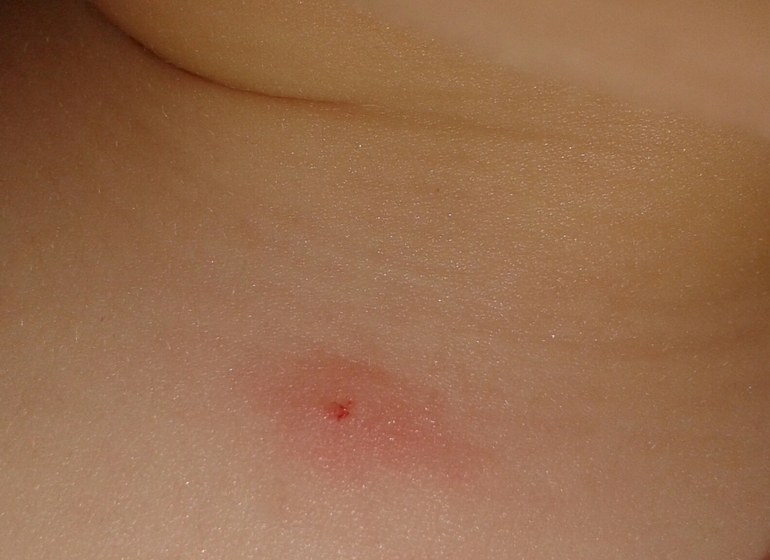 Девочки, быстренько!