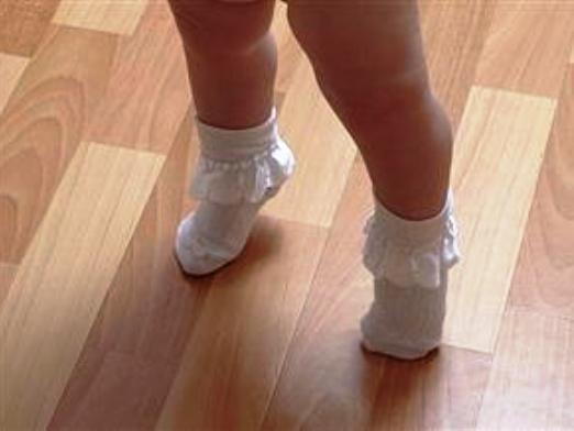 Норма или патология: почему ребенок ходит на носочках