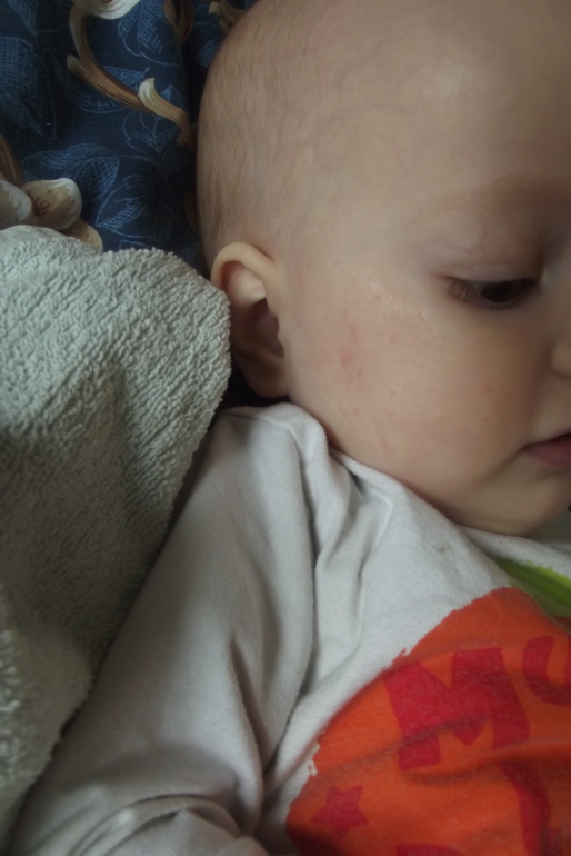 Чем мазать?